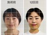 【平日13時～18時限定】小顔矯正コース60分　