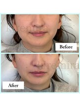 キレミラ 麻布十番店/左右差編