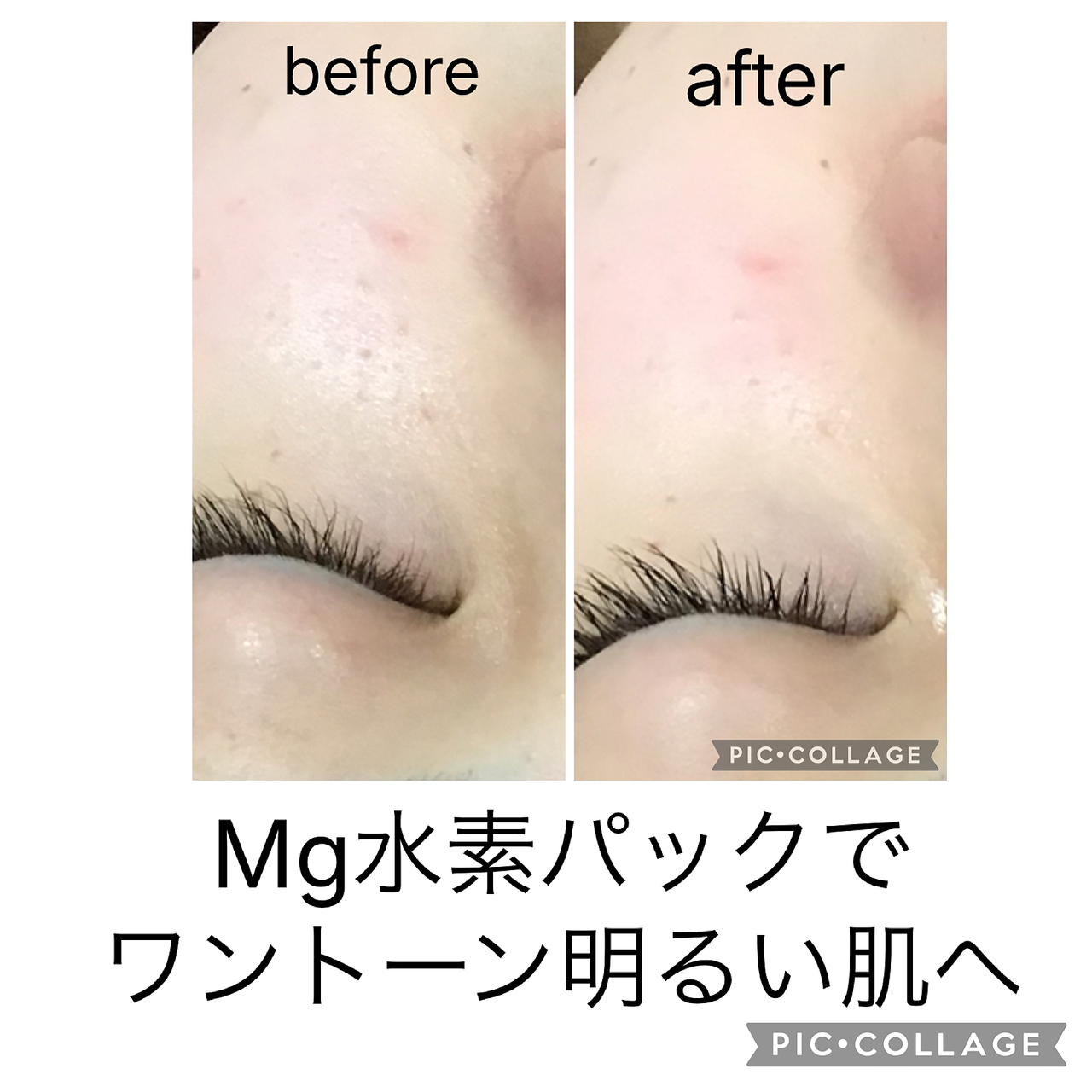 毛穴、シミ、赤みを改善