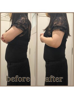 ファビー(Fabby)/マグフォース1回のビフォアフ