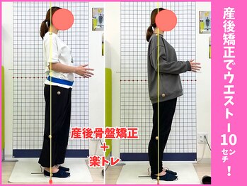 にしぐち鍼灸整骨院 玉串院/産後矯正でサイズdown!20代女性