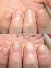 マリーロール 淀屋橋本店(Marie Laure)/自爪育成/深爪矯正/ネイルケア