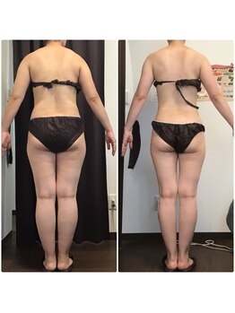 美やせ専門店 ビープロデュース 西尾店(B'PRODUCE)/【40代の方のビフォーアフター】