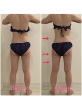 スペチアーレ 夙川/顔もボディもお悩み解決