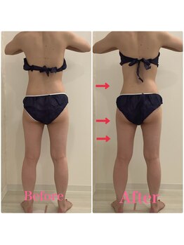 スペチアーレ 夙川/顔もボディもお悩み解決