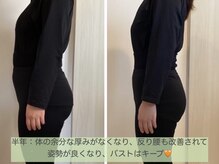 ヨサパーク ベスティ 阿佐ヶ谷(Yosa Park bestie)/ビフォアフ：サイド（半年間）