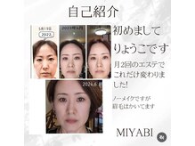 ミヤビ(MIYABI)の雰囲気（月2回のたるみ改善コースとホームケア基礎化粧品でかわりました）
