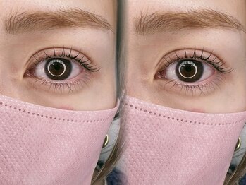 ヴィヴィ(vivi)/ダメージレスまつ毛パーマ