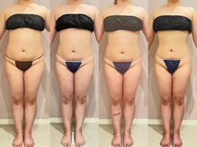 スローティ ラテ 札幌ピヴォ店/痩身マシンの組合せで劇的効果！