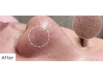 ビューティ サロン ココ ア ドール(Coco a Doll)/