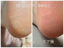 カダン(Kadan)/かかと磨きでツルモチ肌へ！