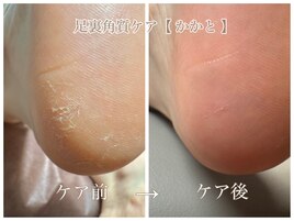 かかと磨きでツルモチ肌へ！