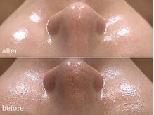 アルページュ(Arpege)/水滴LDM ＆ダーマ韓国MTS