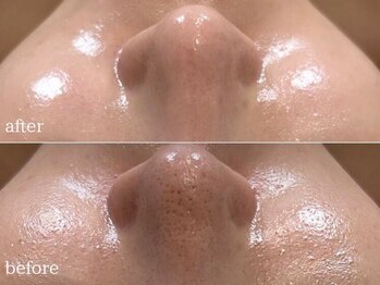 アルページュ(Arpege)/水滴LDM ＆ダーマ韓国MTS