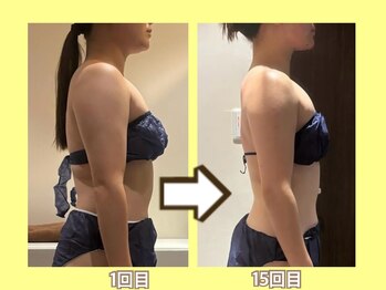 ビオール 池袋店(beall)/大人気!オーダーメイド痩身90分