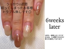 リュージェ(LEWJE)/施術後6週間のお客様