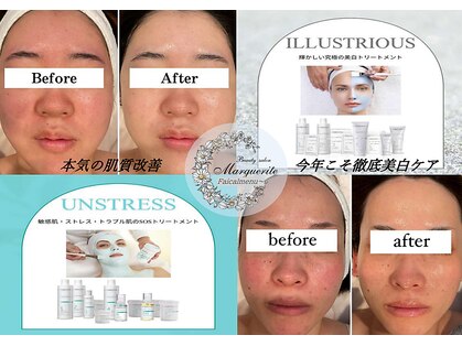 マーガレット(Marguerite)の写真