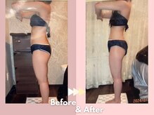 キレイサローネ 銀座店(KIREI SALONE)/☆ビフォーアフターのご紹介☆