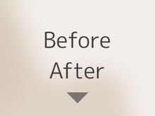 ビューティーサロンリア 栄 伏見店(LI'A)/症例