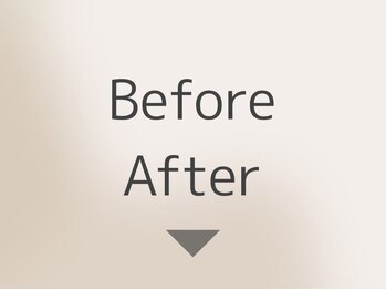 ビューティーサロンリア 栄 伏見店(LI'A)/症例