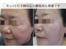 ラグランシエル(Le grand ciel)/お顔の筋トレ