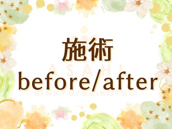 浜町アネックスあさひ整体院/１回での変化に驚き！
