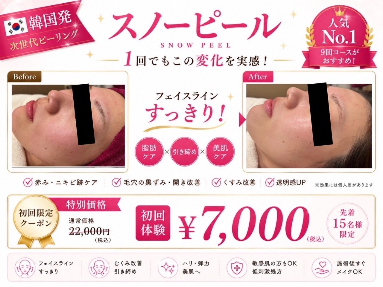 痩身脱毛専門店 グレイスボディ MEGAドンキホーテ三郷店(Gracebody
