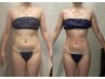 【劇的スリム！凸凹脂肪撃退！】セルバランス　全身フル痩身リンパ　120分