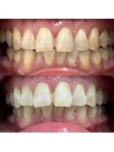 イイハキューブ(e8 cube)/before & after