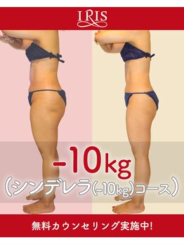 アイリスエステサロン 江州店/ビフォーアフター【1】