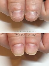 マリーロール 淀屋橋本店(Marie Laure)/自爪育成/深爪矯正/ネイルケア