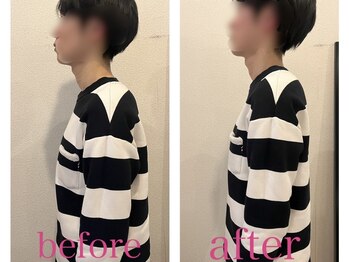 ナチュラルセラピー ドロップ(Drop)/【お悩み】姿勢ストレートネック