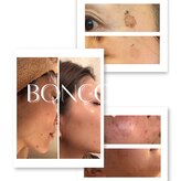 ボンクール(BONCOEUR)