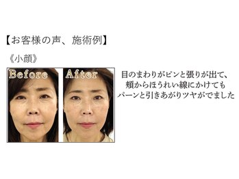 江坂回復アップラボ/お客様の声、施術例