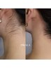 《夏に向けて！》美容成分配合うなじWax