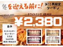 ホワイトニングショップ 名古屋店