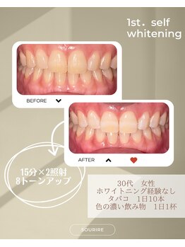 スリール(sourire)/