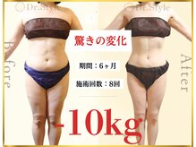 痩身エステ 美容整体 ドクタースタイル(Dr.Style)