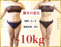 痩身エステ 美容整体 ドクタースタイル(Dr.Style)