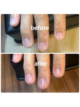 メンズネイルビズ 赤坂(Men's Nail Biz)/NORMAL｜基本ケア