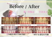 ホワイトニングショップ 春日井店(whitening shop)