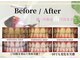 ホワイトニングショップ 春日井店(whitening shop)の写真