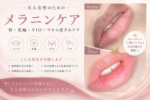 モンロー(MonroE+)