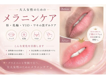 モンロー(MonroE+)の写真