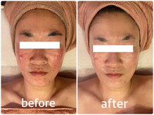 アルコイリス(Arco iris)/コンプレックスから解放