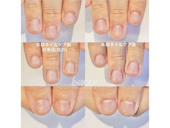 爪育ネイルケア