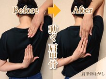 幸せのもり整体院/肩こり・首こり・頭痛改善整体！