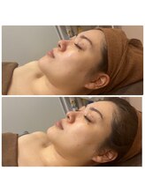 スリーズララ(Cerise La La)/