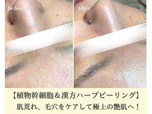 シェリール(cherir)の雰囲気（ニキビケア/毛穴/肌質改善専門店◎ハーブピーリング人気No. 1）