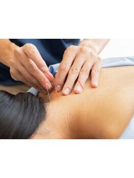 鍼灸施術を受けたい